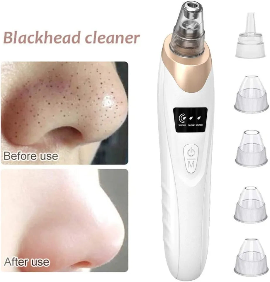 5-in-1 Blackhead Remover Machine | Rechargeable Facial Pore Vacuum